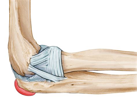 Olecranon bursitis