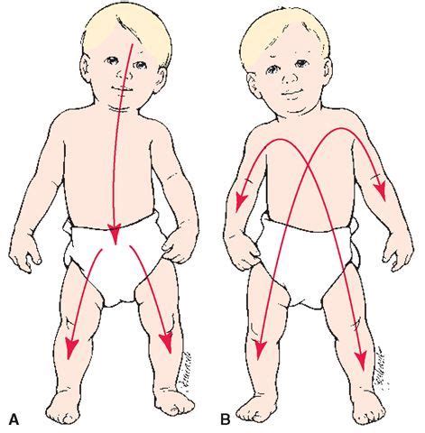 Principles of growth and development. (A) Cephalocaudal growth and development proc… | Childhood ...