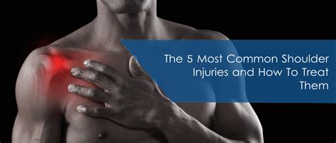 5 Common Shoulder Injuries | Health in Motion | Orthopaedic Care