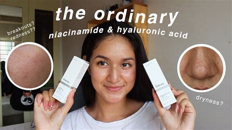 the ordinary niacinamide and hyaluronic acid 1 MONTH review (with ...