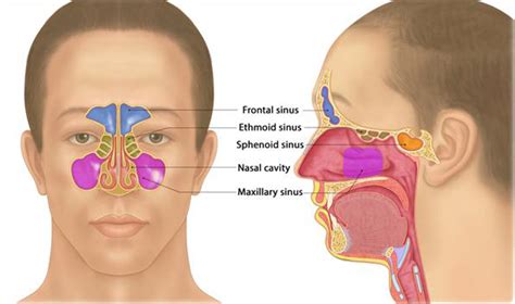 Chronic Rhinosinusitis, Nasal Polyps - Melbourne ENT Group