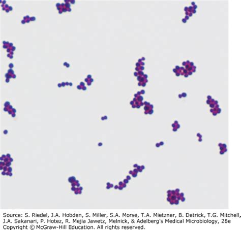 Staphylococcus Aureus Under Microscope 100x - Micropedia