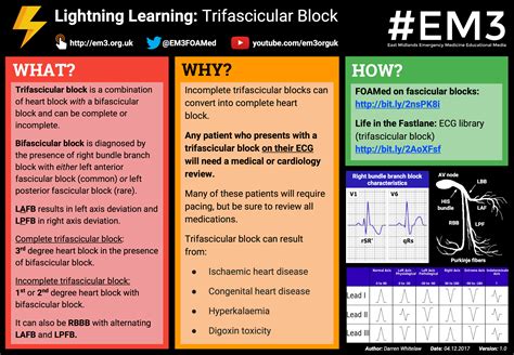 Lightning Learning: Trifascicular Block — #EM3: East Midlands Emergency Medicine Educational Media