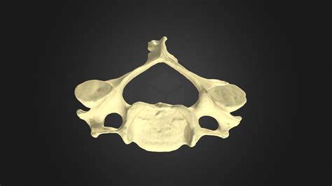 C4 Vertebra - 3D model by UBC Medicine - Educational Media [5516ddc] - Sketchfab