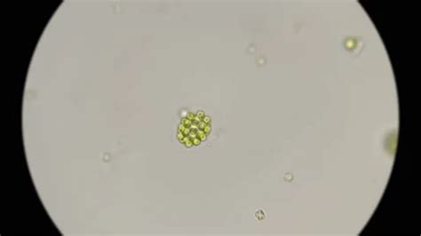 algae Eudorina elegans under a microscop... | Stock Video | Pond5