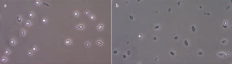 Contrast phase microscope images of untreated (a) and pretreated (b ...