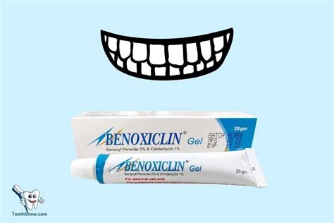 Peroxide Gel Teeth Whitening Side Effects: Gum Irritation!