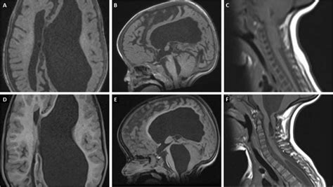 Preoperative studies.A–C: MRI performed during follow-up after ...