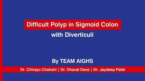 Difficult Polyp in Sigmoid Colon with Diverticuli | By Team AIGHS - YouTube