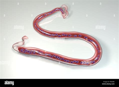 Loa loa filariasis hi-res stock photography and images - Alamy