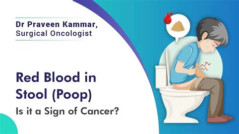 Red Blood in Stool (Poop) – Is it a Sign of Cancer? Dr Praveen Kammar