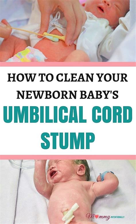 How to Clean Your Newborn Baby's Umbilical Cord Stump | Newborn care, Baby umbilical cord, Newborn