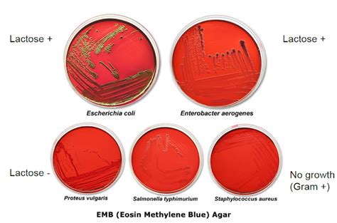 Eosin Methylene Blue (EMB) Agar : Principle ,purpose and colonies characteristics
