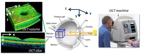 Automated Macular Pathology Diagnosis in Retinal OCT Images