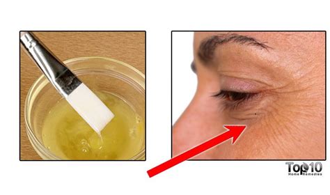 How to Get Rid of Crow's-Feet | Top 10 Home Remedies