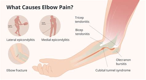 Medial Epicondyle Of Humerus Pain