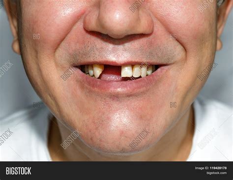 Man Smile Without Image & Photo (Free Trial) | Bigstock