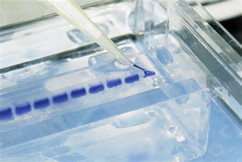 Samples Of Dna Being Loaded Onto An Agarose Gel Photograph by Klaus Guldbrandsen/science Photo ...