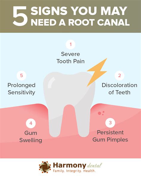 Emergency Root Canals: Your Guide to Relief - Dr. da Costa