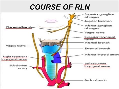 Recurrent laryngeal nerve paralysis