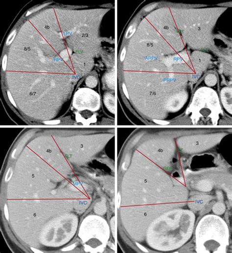 Liver | Radiology Key