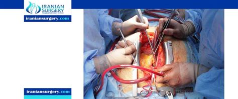 Types of Heart Surgery | Heart Surgery Types | Iranian Surgery