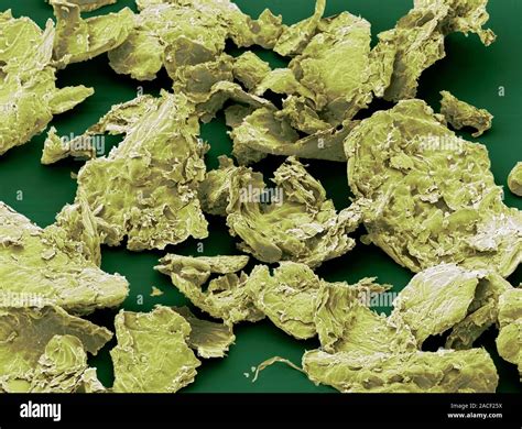 Flakes of dead skin. Coloured scanning electron micrograph (SEM) of ...