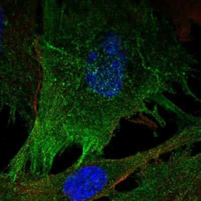 Myosin light chain kinase Antibody (NBP2-68679): Novus Biologicals