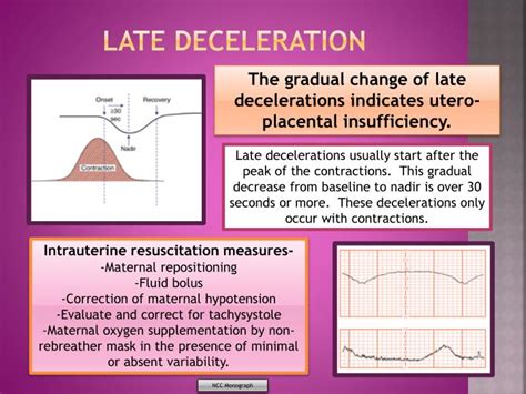 PPT - Electronic Fetal Monitoring PowerPoint Presentation - ID:3156047