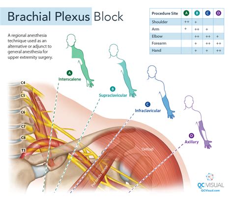 Medical Illustrations Portfolio - QCVISUAL