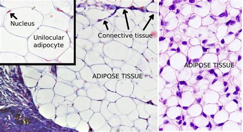 Cell types. Unilocular adipocyte. Atlas of plant and animal histology