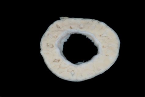 Cross section slice of the wall of the proventriculus of the chicken (formalin fixed specimen ...