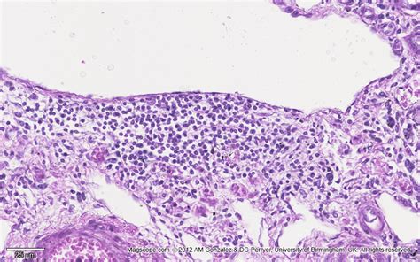 High magnification micrograph of a kidney section illustrating the simple squamous epithelium of ...