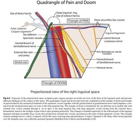 Triangle Of Doom And Pain