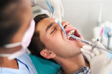 Dental Rehabilitation Under General Anesthesia at melissarbrown blog