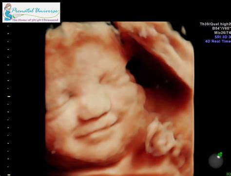 3D Ultrasound Pricing - Prenatal Universe - Tacoma, WA