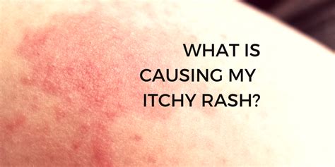 What is causing my itchy rash? - thegoodlife4us