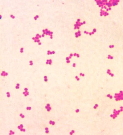 Bacteriology (Week 2) Gram Negative Cocci: Neisseria and Moraxella Flashcards | Quizlet