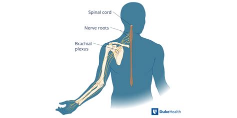 Brachial Plexus Injury | Duke Health