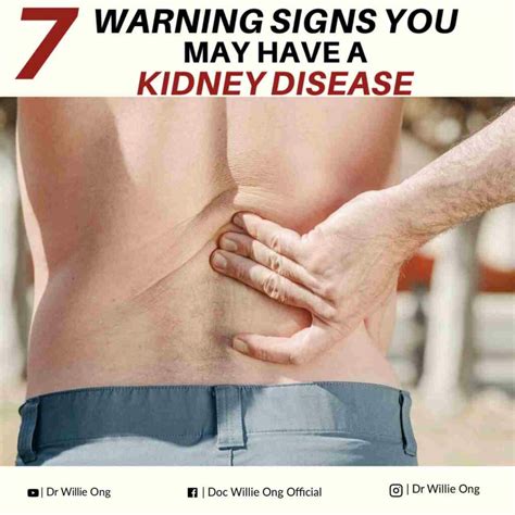 7 Warning Signs You May Have Kidney Disease - Doc Willie Ong