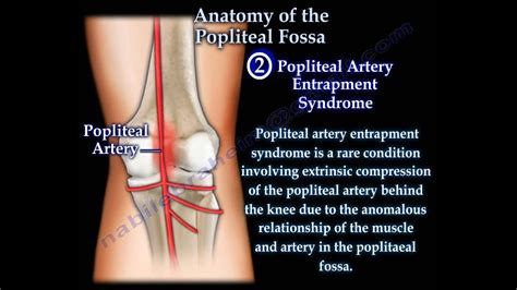 Anatomy Of The Popliteal Fossa - Everything You Need To Know - Dr. Nabil Ebraheim - YouTube