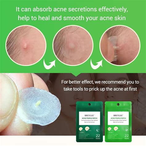 Acne Pimple Patch Remover Blackhead Blemish Treatment Sticker