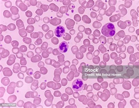 Photomicrograph Of Hematological Slide Showing Rbc Wbc And Platelet ...