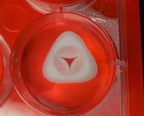 3D Bioprinting Replacement Heart Valves - Allevi