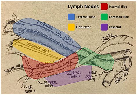 Frontiers | The Role of Lymph Node Dissection in the Treatment of Bladder Cancer | Surgery