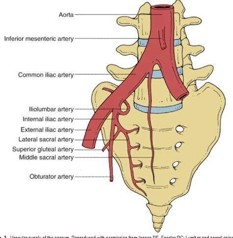 Figure 3 from Sacral fractures. | Semantic Scholar