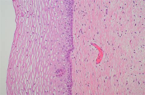 Cervix Histology