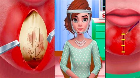 ASMR Surgery | Broken Chin Treatment | Pimple, Acne, Blackhead Removal | Animation | CARTOONET ...