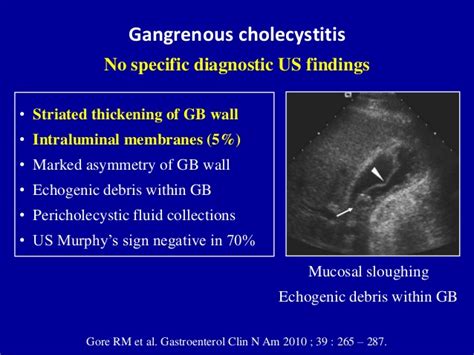 MEDICAL ULTRASOUND/ACUTE AND CHRONIC CHOLECYSTITIS