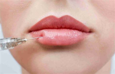 Russian Lip Fillers- RussianLips.com